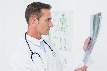 simsearch:400-07269643,k - Concentrated male doctor looking at spine x-ray in the medical office Fotografie stock - Microstock e Abbonamento, Codice: 400-07269264