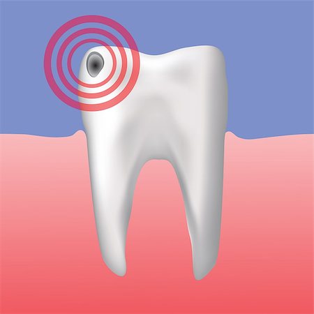 colorful illustration with hole in the tooth for your design Stock Photo - Budget Royalty-Free & Subscription, Code: 400-07477190