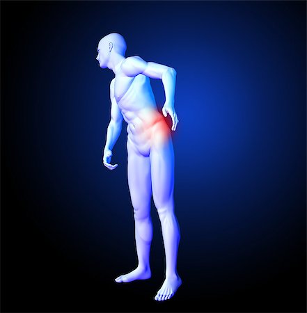 3D render of a medical man with back pain highlighted Stock Photo - Budget Royalty-Free & Subscription, Code: 400-07472427