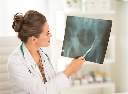 simsearch:400-07099823,k - Medical doctor woman pointing on fluorography Stock Photo - Budget Royalty-Free & Subscription, Code: 400-07519216