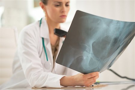simsearch:400-07519214,k - Closeup on medical doctor woman with phone looking on fluorography Stock Photo - Budget Royalty-Free & Subscription, Code: 400-07519225