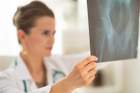 simsearch:400-07099823,k - Closeup on medical doctor woman looking on fluorography Stock Photo - Budget Royalty-Free & Subscription, Code: 400-07519228