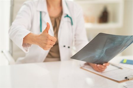 simsearch:400-07519214,k - Closeup on medical doctor woman with fluorography showing thumbs up Stock Photo - Budget Royalty-Free & Subscription, Code: 400-07519234