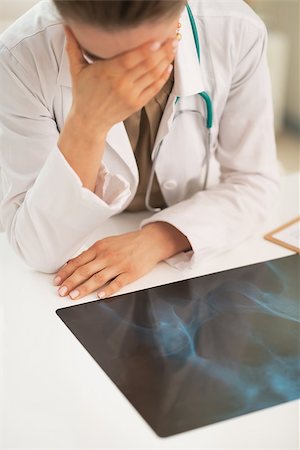 simsearch:400-07519214,k - Stressed medical doctor woman with fluorography in office Stock Photo - Budget Royalty-Free & Subscription, Code: 400-07519231