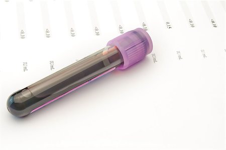 test tubes with blood on top of lab test results Stock Photo - Budget Royalty-Free & Subscription, Code: 400-07513511