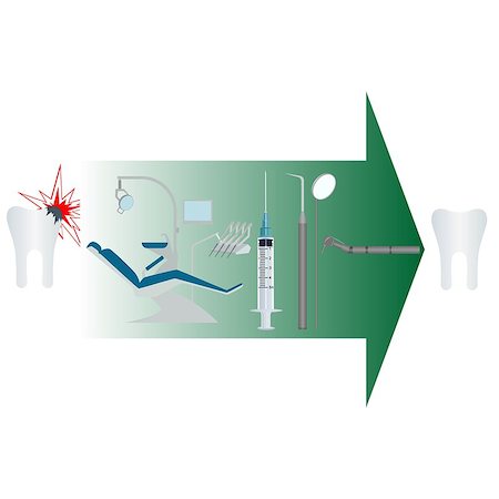 dental drill drawing - Treatment of diseased tooth. Illustration on white background. Foto de stock - Super Valor sin royalties y Suscripción, Código: 400-07614775