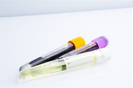 simsearch:400-06916693,k - chemical test tube on the table Stock Photo - Budget Royalty-Free & Subscription, Code: 400-07618391