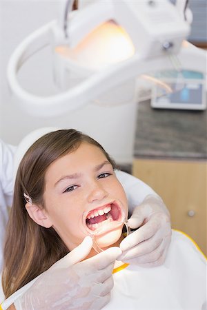 simsearch:400-07684901,k - Dentist putting mouth retractor on little girl at the dental clinic Stock Photo - Budget Royalty-Free & Subscription, Code: 400-07684912