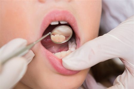 simsearch:400-07684901,k - Pediatric dentist examining a little girls teeth in the dentists chair at the dental clinic Stock Photo - Budget Royalty-Free & Subscription, Code: 400-07684945
