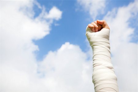 raise bandaged arm  with blue sky background Stock Photo - Budget Royalty-Free & Subscription, Code: 400-07716021