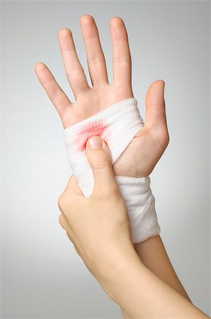 simsearch:400-07669067,k - Injured hand with bloody white gauze bandage Fotografie stock - Microstock e Abbonamento, Codice: 400-07724140