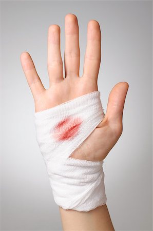 simsearch:400-07669067,k - Woman's hand with bloody white gauze bandage Fotografie stock - Microstock e Abbonamento, Codice: 400-07728065