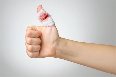 simsearch:400-07831838,k - Injured finger with bloody gauze bandage Foto de stock - Royalty-Free Super Valor e Assinatura, Número: 400-07728508