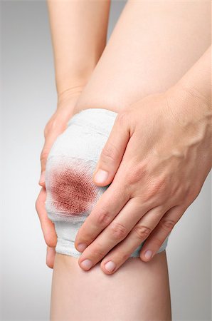 simsearch:400-07831838,k - Injured painful knee with white gauze bandage Foto de stock - Royalty-Free Super Valor e Assinatura, Número: 400-07729361