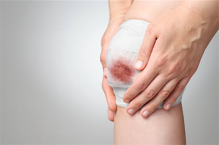 simsearch:400-07824013,k - Injured painful knee with white gauze bandage Foto de stock - Royalty-Free Super Valor e Assinatura, Número: 400-07729807