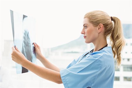 simsearch:400-06634198,k - Concentrated female doctor examining x-ray in the medical office Stock Photo - Budget Royalty-Free & Subscription, Code: 400-07778141