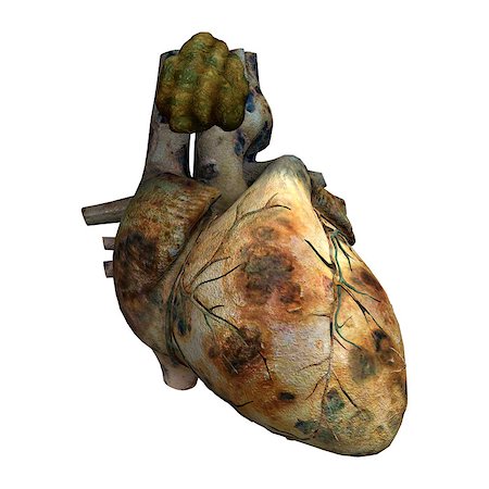 simsearch:400-07116715,k - 3D digital render of a sick human heart isolated on white background Stock Photo - Budget Royalty-Free & Subscription, Code: 400-07770355