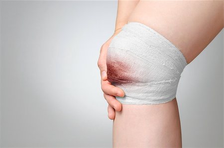 simsearch:400-07669067,k - Injured painful knee with bloody gauze bandage Fotografie stock - Microstock e Abbonamento, Codice: 400-07817306