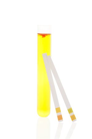 simsearch:625-00899089,k - PH test strips, litmus paper and urine with blood in test tube isolated on white background. Minimal medical health care background. Stockbilder - Microstock & Abonnement, Bildnummer: 400-07825811