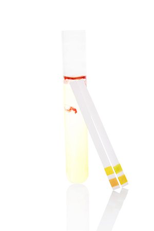 simsearch:625-00899089,k - Urine sample with blood in test tube and pH litmus paper test strips isolated on white background. Acidic or alkaline, health or disease. Health and medical concept. Stockbilder - Microstock & Abonnement, Bildnummer: 400-07825812