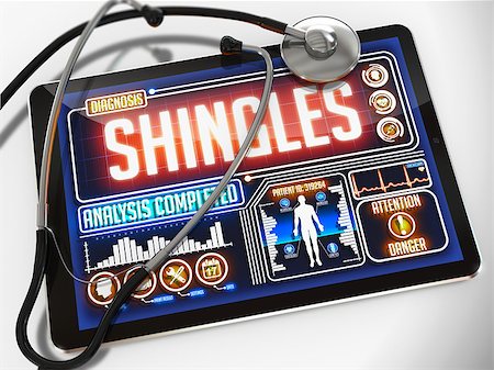 simsearch:400-08750298,k - Medical Tablet with the Diagnosis of Shingles on the Display and a Black Stethoscope on White Background. Stockbilder - Microstock & Abonnement, Bildnummer: 400-07837955