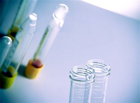 simsearch:400-07774098,k - detail of test tubes in hospital laboratory on table with space for text Stock Photo - Budget Royalty-Free & Subscription, Code: 400-07831954