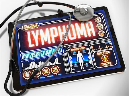 Medical Tablet with the Diagnosis of Lymphoma on the Display and a Black Stethoscope on White Background. Stock Photo - Budget Royalty-Free & Subscription, Code: 400-07832380
