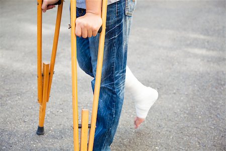 simsearch:400-07976358,k - closeup of leg on bandage with crutches Stock Photo - Budget Royalty-Free & Subscription, Code: 400-07891822