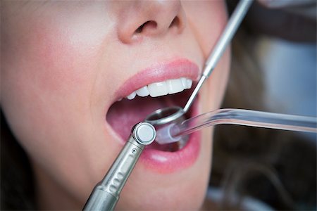 simsearch:400-07938964,k - Close up of woman having her teeth examined by dentist Stockbilder - Microstock & Abonnement, Bildnummer: 400-07939053