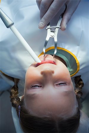 simsearch:400-07938964,k - Close up of girl having her teeth examined by a dentist Stockbilder - Microstock & Abonnement, Bildnummer: 400-07939088