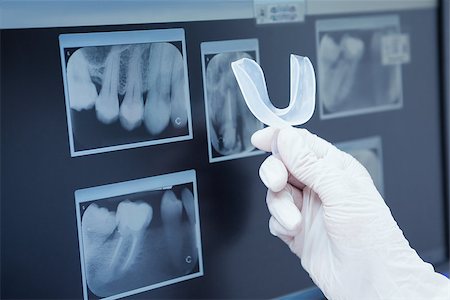 simsearch:6109-08389794,k - Close up of teeth x-ray Stockbilder - Microstock & Abonnement, Bildnummer: 400-07939110