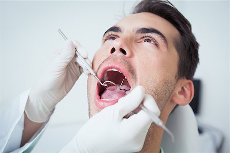 simsearch:6109-08389794,k - Close up of man having his teeth examined by dentist Stockbilder - Microstock & Abonnement, Bildnummer: 400-07939177