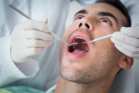 simsearch:6109-08389794,k - Close up of man having his teeth examined by dentist Stockbilder - Microstock & Abonnement, Bildnummer: 400-07939186