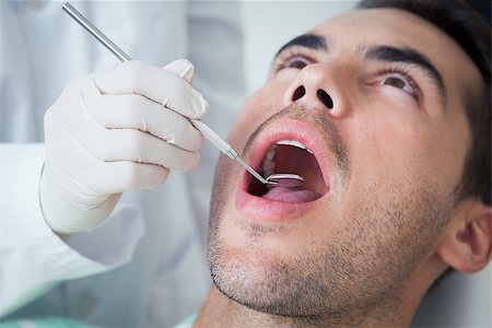 simsearch:6109-08389794,k - Close up of man having his teeth examined by dentist Stockbilder - Microstock & Abonnement, Bildnummer: 400-07939187