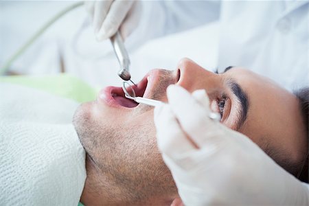 simsearch:6109-08389794,k - Close up of man having his teeth examined by dentist Stockbilder - Microstock & Abonnement, Bildnummer: 400-07939196