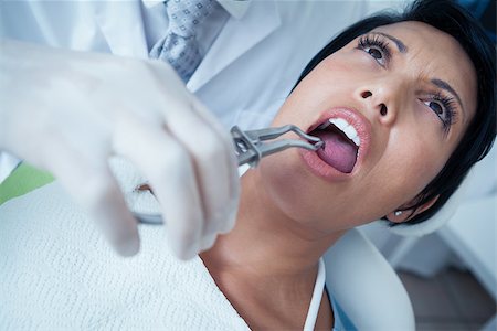 simsearch:6109-08389794,k - Close up of woman having her teeth examined by dentist Stockbilder - Microstock & Abonnement, Bildnummer: 400-07939248