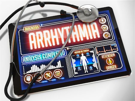 Arrhythmia- Diagnosis on the Display of Medical Tablet and a Black Stethoscope on White Background. Foto de stock - Super Valor sin royalties y Suscripción, Código: 400-07995312