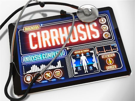 Cirrhosis - Diagnosis on the Display of Medical Tablet and a Black Stethoscope on White Background. Stock Photo - Budget Royalty-Free & Subscription, Code: 400-07996277