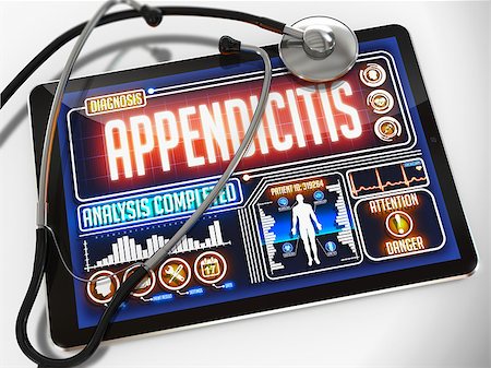 Appendicitis - Diagnosis on the Display of Medical Tablet and a Black Stethoscope on White Background. Stock Photo - Budget Royalty-Free & Subscription, Code: 400-07996917