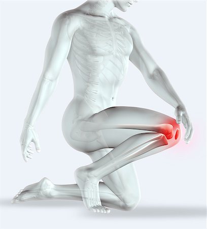 3D render of a male figure holding his knee in pain with muscle map Stock Photo - Budget Royalty-Free & Subscription, Code: 400-08020616