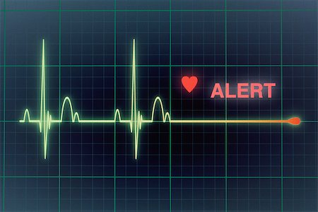 electrocardiogram - Flat line alert on a heart monitor. Stock Photo - Budget Royalty-Free & Subscription, Code: 400-08074070