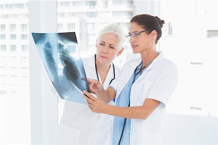 simsearch:400-07269250,k - female doctors examining x-ray in the medical office Stock Photo - Budget Royalty-Free & Subscription, Code: 400-08136041