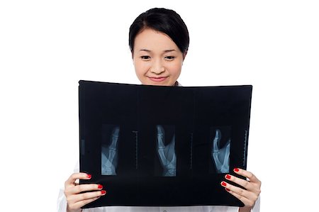 simsearch:400-08131186,k - Female physician analyzing x-ray sheet of patient Stock Photo - Budget Royalty-Free & Subscription, Code: 400-08187116