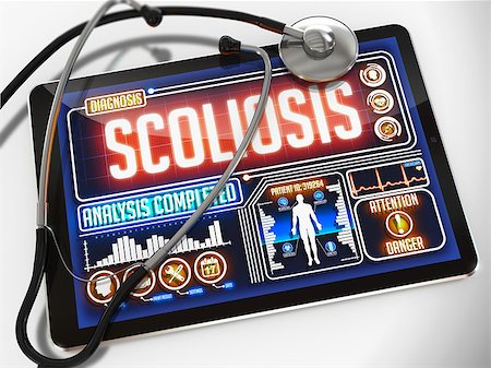 simsearch:400-09000460,k - Scoliosis - Diagnosis on the Display of Medical Tablet and a Black Stethoscope on White Background. Stock Photo - Budget Royalty-Free & Subscription, Code: 400-08188157