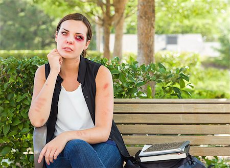 simsearch:400-07313485,k - Sad Bruised and Battered Young Woman Sitting on Bench Outside at a Park. Stock Photo - Budget Royalty-Free & Subscription, Code: 400-08253490
