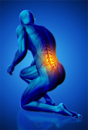 simsearch:400-08647675,k - 3D blue male medical figure with lower spine highlighted in kneeling position Stockbilder - Microstock & Abonnement, Bildnummer: 400-08287766
