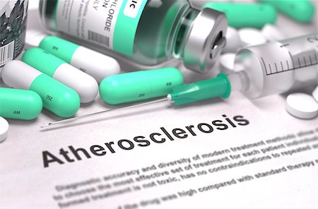 Atherosclerosis - Printed Diagnosis with Blurred Text. On Background of Medicaments Composition - Mint Green Pills, Injections and Syringe. Stock Photo - Budget Royalty-Free & Subscription, Code: 400-08300024