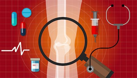 simsearch:400-08318516,k - arthritis joint bone problem health care illustration rheumatoid vector Stockbilder - Microstock & Abonnement, Bildnummer: 400-08336693