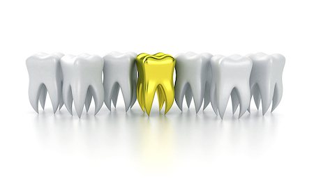 simsearch:400-06108956,k - Illustration of a row white teeth with one gold between them Fotografie stock - Microstock e Abbonamento, Codice: 400-08375127