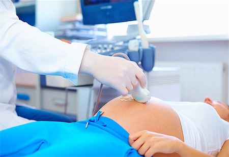 pregnant scan - doctor conducting the ultrasound procedure to pregnant woman Stock Photo - Budget Royalty-Free & Subscription, Code: 400-08400914